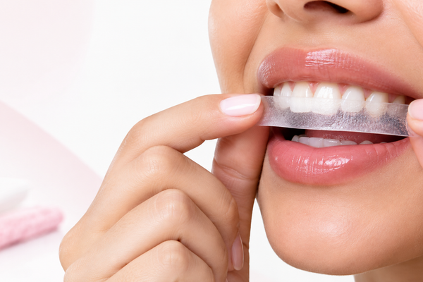 What Are Teeth Whitening Strips & How Do They Work? | OroDent