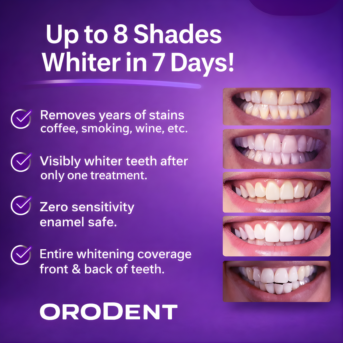 OroDent PAP Whitening Strips